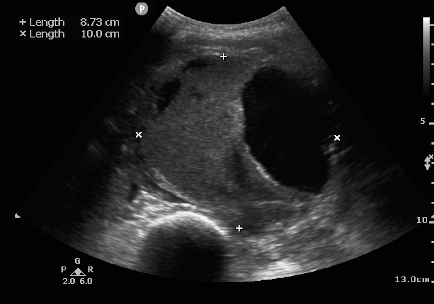 POCUS Focused