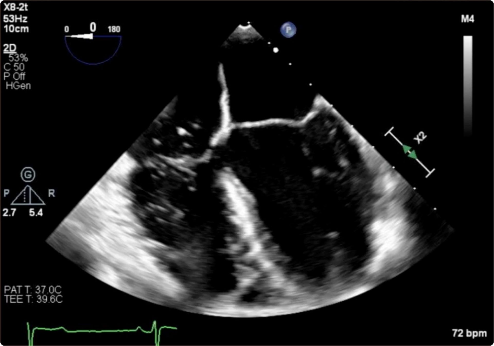 POCUS Focused
